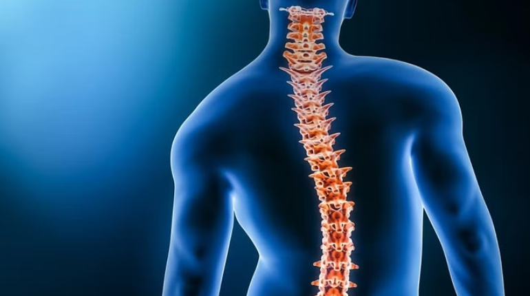 Is Scoliosis Surgery Safe? Risks, Success Rates and Recovery